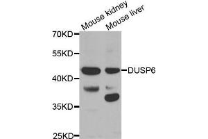 Western blot analysis of extracts of various tissues, using DUSP6 antibody. (DUSP6 antibody  (AA 1-170))
