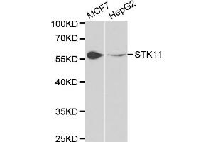 Western blot analysis of extracts of various cell lines, using STK11 antibody (ABIN5971149) at 1/1000 dilution. (LKB1 antibody)