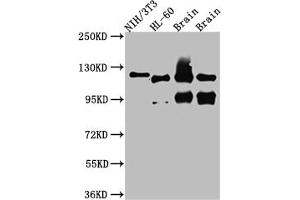 Western Blot Positive WB detected in: NIH/3T3 whole cell lysate, HL-60 whole cell lysate, Rat Brain whole cell lysate, Mouse Brain whole cell lysate All lanes: OGT antibody at 1:1000 Secondary Goat polyclonal to rabbit IgG at 1/50000 dilution Predicted band size: 117, 104, 116, 75 kDa Observed band size: 117 kDa (Recombinant OGT antibody)