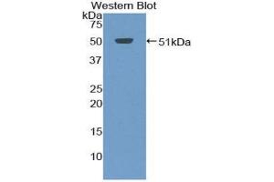 Western Blotting (WB) image for anti-Tumor Necrosis Factor Receptor Superfamily, Member 13C (TNFRSF13C) (AA 3-175) antibody (ABIN3208905) (TNFRSF13C antibody  (AA 3-175))