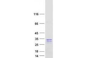 Validation with Western Blot (SCG5 Protein (Transcript Variant 1) (Myc-DYKDDDDK Tag))