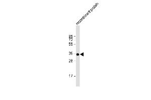 Anti-BRCA2 Antibody at 1:2000 dilution + recombinant protein Lysates/proteins at 20 μg per lane. (BRCA2 antibody  (AA 251-495))