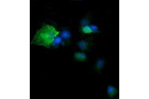Image no. 4 for anti-Deleted in Primary Ciliary Dyskinesia Homolog (DPCD) antibody (ABIN1497889) (DPCD antibody)