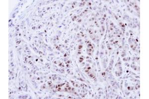 IHC-P Image Immunohistochemical analysis of paraffin-embedded A549 Xenograft, using NEK4, antibody at 1:100 dilution. (NEK4 antibody)