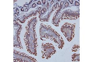 IHC analysis of DDR1 using anti-DDR1 antibody (ABIN7601407). (DDR1 antibody  (AA 341-909))