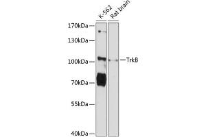 Western blot analysis of extracts of various cell lines, using TrkB Antibody (ABIN6128381, ABIN6144905, ABIN6144907 and ABIN6215569) at 1:3000 dilution.