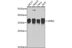 Western blot analysis of extracts of various cell lines, using SMN2 Rabbit pAb (ABIN6127949, ABIN6148136, ABIN6148139 and ABIN6218739) at 1:1000 dilution. (SMN2 antibody  (AA 1-197))
