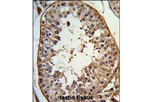 Formalin-fixed and paraffin-embedded human testis tissue reacted with ANGEL1 Antibody , which was peroxidase-conjugated to the secondary antibody, followed by DAB staining. (ANGEL1 antibody  (C-Term))