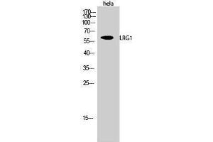 Western Blotting (WB) image for anti-Leucine-Rich alpha-2 Glycoprotein 1 (LRG1) (C-Term) antibody (ABIN3185409) (LRG1 antibody  (C-Term))