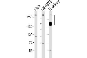 All lanes : Anti-SPTAN1 Antibody (Center) at 1:1000 dilution Lane 1: Hela whole cell lysates Lane 2: NIH/3T3 whole cell lysates Lane 3: rat kidney lysates Lysates/proteins at 20 μg per lane. (SPTAN1 antibody  (AA 977-991))