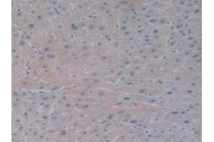 Detection of BMP10 in Human Liver Tissue using Monoclonal Antibody to Bone Morphogenetic Protein 10 (BMP10) (BMP10 antibody  (AA 315-424))