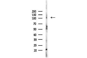 anti-Nucleotide-Binding Oligomerization Domain Containing 2 (NOD2) (N-Term) antibody