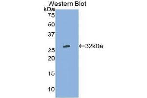 Western Blotting (WB) image for anti-Tryptophanyl-tRNA Synthetase (WARS) (AA 247-458) antibody (ABIN1860957) (WARS antibody  (AA 247-458))