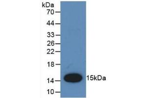 Detection of Recombinant MCP1, Rat using Polyclonal Antibody to Monocyte Chemotactic Protein 1 (MCP1) (CCL2 antibody  (AA 24-148))