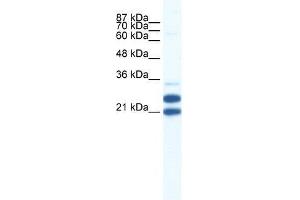 TRIM34 antibody used at 0. (TRIM34 antibody  (N-Term))
