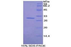 SDS-PAGE analysis of Mouse SIK2 Protein. (SIK2 Protein)