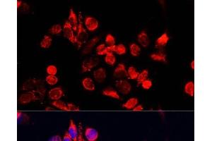 Immunofluorescence analysis of HeLa cells using NFE2L1 Polyclonal Antibody at dilution of 1:100. (NFE2L1 antibody)