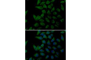 Immunofluorescence analysis of U2OS cells using PLOD2 antibody.