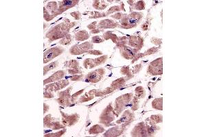Antibody staining SPHK1 in human heart tissue sections by Immunohistochemistry (IHC-P - paraformaldehyde-fixed, paraffin-embedded sections).