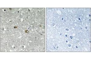 Immunohistochemistry analysis of paraffin-embedded human brain tissue, using PIGH Antibody. (PIGH antibody  (AA 137-186))