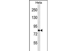 ZN Antibody (Center) (ABIN1538066 and ABIN2848974) western blot analysis in Hela cell line lysates (35 μg/lane).