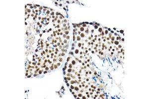 Immunohistochemistry of paraffin-embedded mouse testis using SF3 Rabbit pAb (ABIN1682671, ABIN3018959, ABIN3018960 and ABIN6220644) at dilution of 1:100 (40x lens).