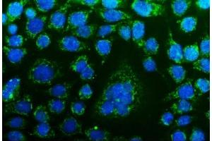 IF analysis of CHCHD10 using anti-CHCHD10 antibody (ABIN7602507). (CHCHD10 antibody  (AA 80-142))