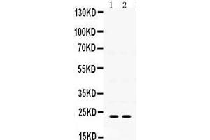 Observed bind size: 23KD (IGFBP5 antibody  (N-Term))