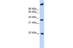 WB Suggested Anti-SSBP3 Antibody Titration: 0. (SSBP3 antibody  (Middle Region))