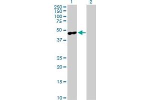 Western Blot analysis of MAGEA4 expression in transfected 293T cell line by MAGEA4 MaxPab polyclonal antibody.
