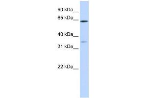 WB Suggested Anti-TRIM45 Antibody Titration:  0. (TRIM45 antibody  (Middle Region))