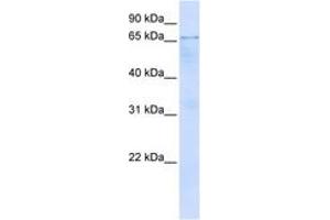 Image no. 1 for anti-Optineurin (OPTN) (N-Term) antibody (ABIN6742870) (OPTN antibody  (N-Term))