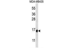 TAC4 Antibody (C-term) western blot analysis in MDA-MB435 cell line lysates (35µg/lane). (Tachykinin 4 antibody  (C-Term))