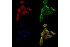 ABIN6260974 and ABIN6273103 staining Hela cells by IF/ICC.