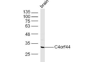 Mouse Brain lysates probed with C4orf44 Polyclonal Antibody, Unconjugated  at 1:300 overnight at 4˚C. (MSANTD1 antibody  (AA 50-100))