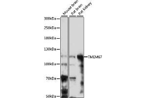 Western blot analysis of extracts of various cell lines, using TMEM67 antibody (ABIN7270970) at 1:1000 dilution. (TMEM67 antibody  (AA 780-940))