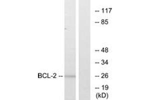 Western blot analysis of extracts from MCF7 cells, treated with Etoposide, using BCL-2 (Ab-56) Antibody. (Bcl-2 antibody  (AA 26-75))