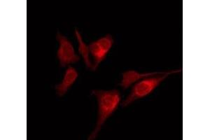 ABIN6275845 staining Hela by IF/ICC. (HUNK antibody  (Internal Region))