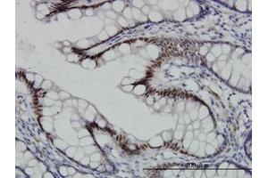 Image no. 1 for anti-Transcription Factor 7-Like 2 (T-Cell Specific, HMG-Box) (TCF7L2) (AA 490-597) antibody (ABIN466104) (TCF7L2 antibody  (AA 490-597))