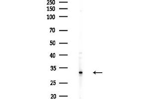 anti-Ras Suppressor Protein 1 (RSU1) (C-Term) antibody