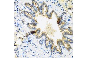 Immunohistochemistry of paraffin-embedded rat lung using DEFB4A antibody at dilution of 1:100 (40x lens). (Defensin beta 4 antibody)