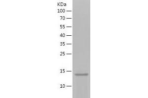 Western Blotting (WB) image for KiSS-1 Metastasis-Suppressor (KISS1) (AA 20-110) protein (His tag) (ABIN7282398) (KISS1 Protein (AA 20-110) (His tag))
