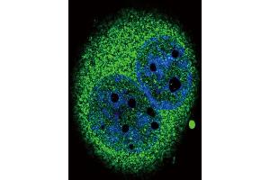 Confocal immunofluorescent analysis of IRF5 Antibody (N-term) (ABIN389333 and ABIN2839445) with A549 cell followed by Alexa Fluor? (IRF5 antibody  (N-Term))