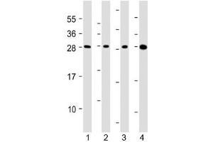 Western blot testing of human 1) HepG2, 2) U266B1, 3) HEK293 and 4) testis lysate with CLEC1B antibody at 1:2000.