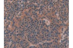 Olfactomedin 4 antibody  (AA 238-500)