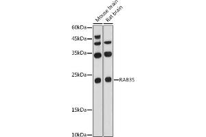 Western blot analysis of extracts of various cell lines, using R antibody (ABIN6133143, ABIN6146576, ABIN6146578 and ABIN6224057) at 1:1000 dilution. (RAB35 antibody  (AA 1-201))