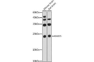 RAB35 antibody  (AA 1-201)