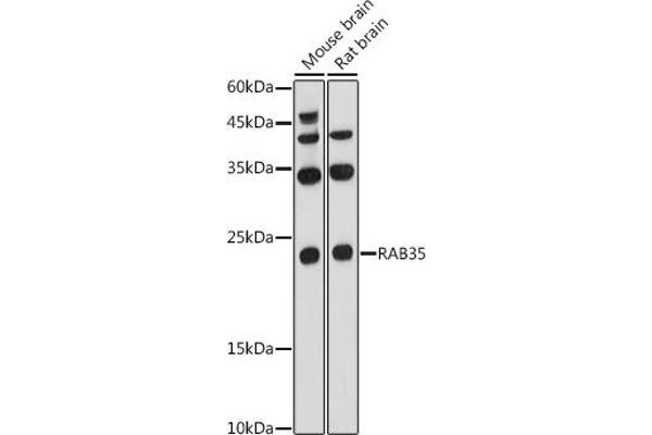 RAB35 antibody  (AA 1-201)