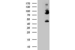 Image no. 3 for anti-Coagulation Factor XIII, A1 Polypeptide (F13A1) antibody (ABIN1498152) (F13A1 antibody)