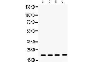 Western Blotting (WB) image for anti-Non-Metastatic Cells 1, Protein (NM23A) Expressed in (NME1) (AA 26-58), (N-Term) antibody (ABIN3043572) (NME1 antibody  (N-Term))